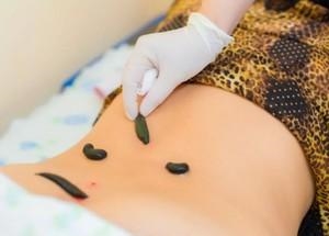 Укусы пиявок