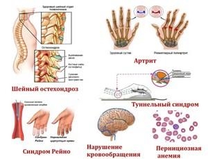 Заболевания,