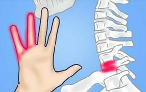 Межпозвоночная грыжа